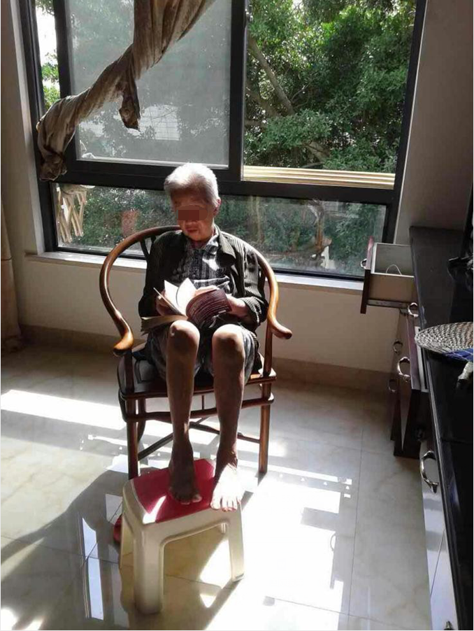 白內障,白內障手術(shù)