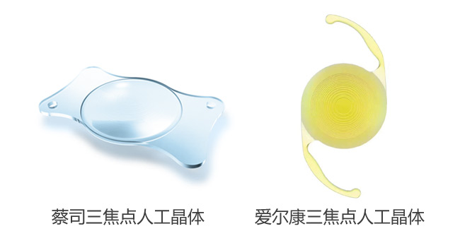 白內障手術(shù)