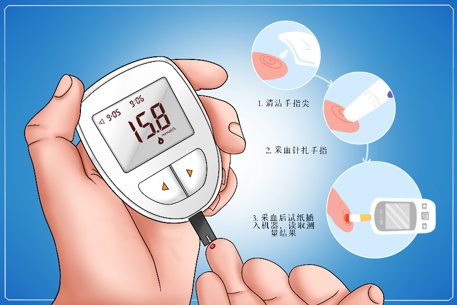 糖尿病視網膜病變